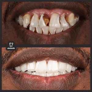 before-after-ftoto_01